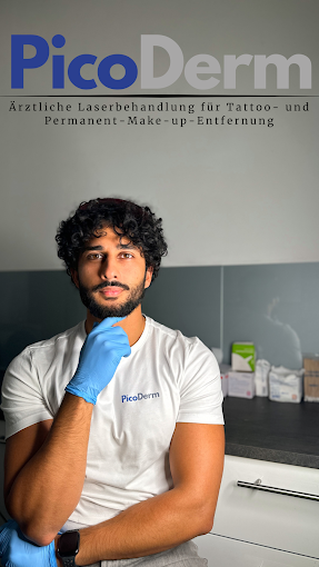 Tattooentfernung in Köln